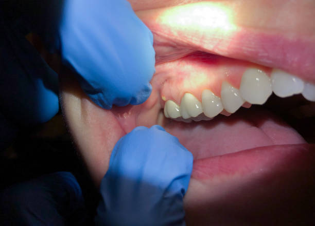 Best Broken or Chipped Tooth Repair in Hampton, MD